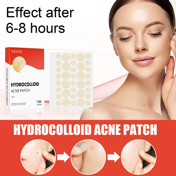 Hydrocolloid Acne Patches - Invisible Makeup, Closed Comedone, Acne-Fighting, Waterproof, Breathable Facial Care