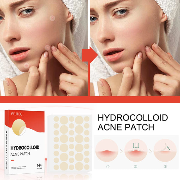Hydrocolloid Acne Patches - Invisible Makeup, Closed Comedone, Acne-Fighting, Waterproof, Breathable Facial Care